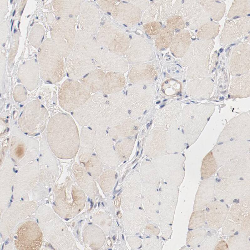 UBE2J1 Antibody - BSA Free Immunohistochemistry-Paraffin: UBE2J1 Antibody - BSA Free [NBP1-85654]