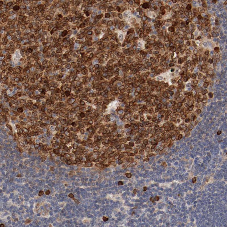 UBE2J1 Antibody - BSA Free Immunohistochemistry-Paraffin: UBE2J1 Antibody - BSA Free [NBP1-85654]