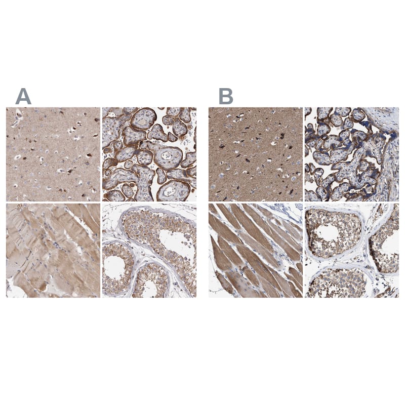 MECR Antibody - BSA Free (NBP1-85657) by Novus, Part of Bio-Techne