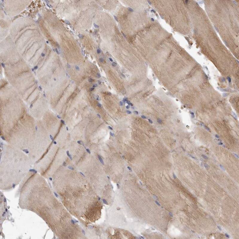MECR Antibody - BSA Free (NBP1-85657) by Novus, Part of Bio-Techne