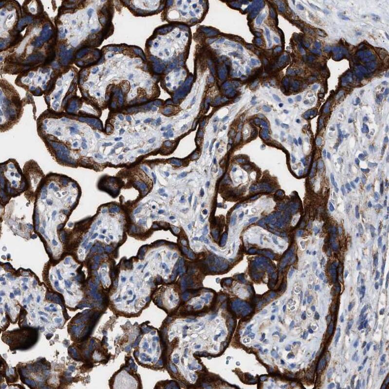 MECR Antibody - BSA Free Immunohistochemistry-Paraffin: MECR Antibody - BSA Free [NBP1-85658]