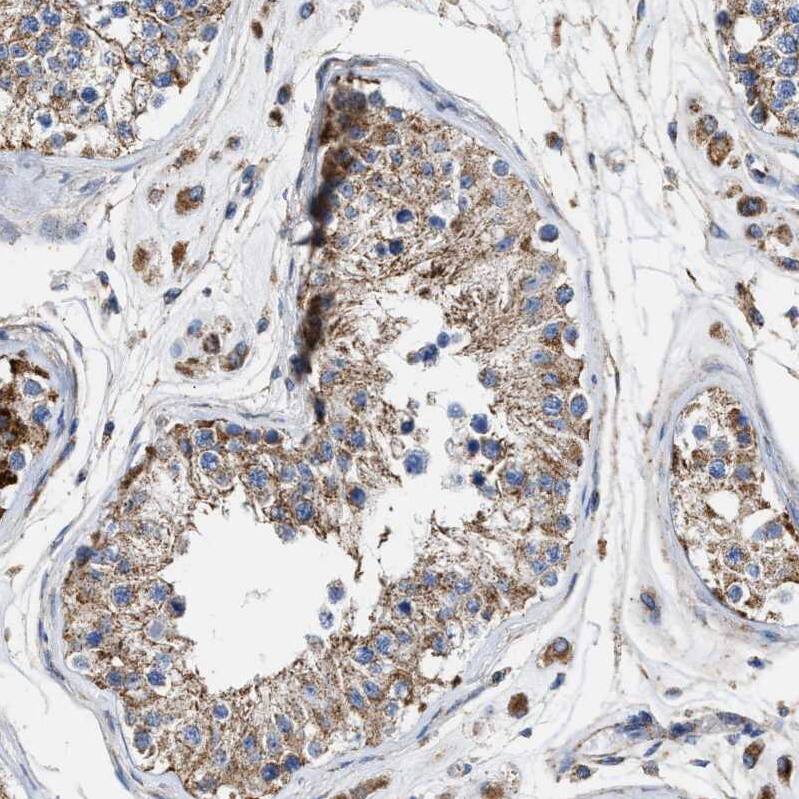 MECR Antibody - BSA Free Immunohistochemistry-Paraffin: MECR Antibody - BSA Free [NBP1-85658]