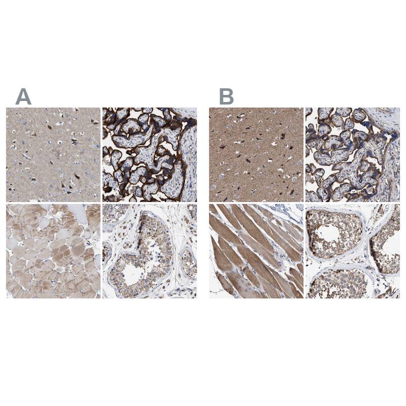 MECR Antibody - BSA Free Immunohistochemistry-Paraffin: MECR Antibody - BSA Free [NBP1-85658]