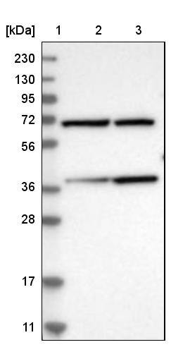 MECR Antibody - BSA Free Western Blot: MECR Antibody - BSA Free [NBP1-85658]