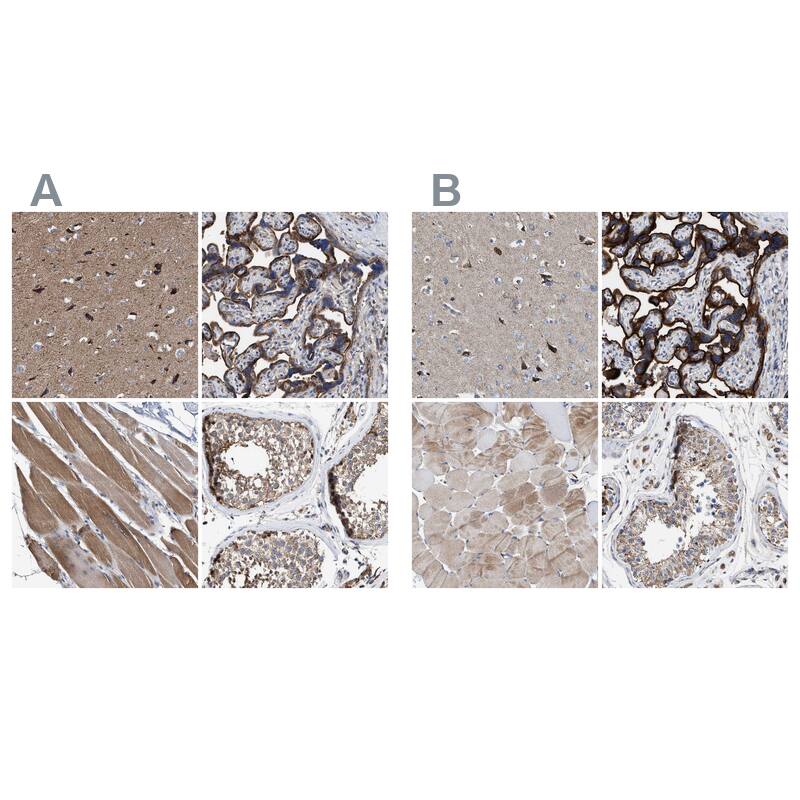 MECR Antibody - BSA Free Immunohistochemistry-Paraffin: MECR Antibody - BSA Free [NBP1-85659]