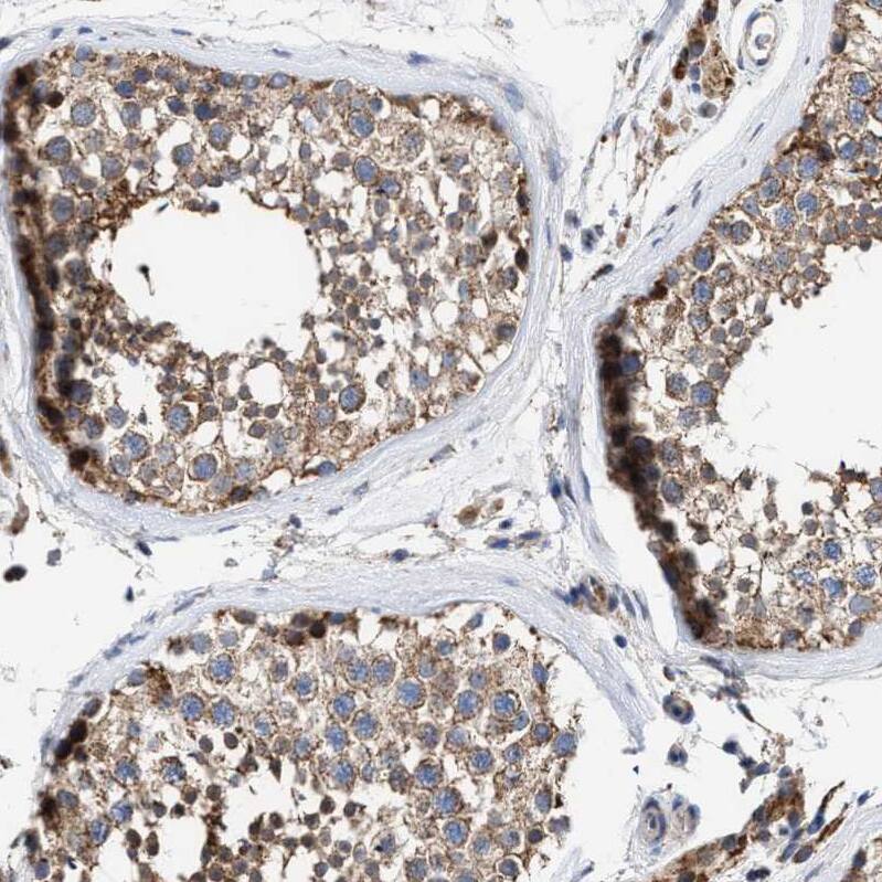 MECR Antibody - BSA Free Immunohistochemistry-Paraffin: MECR Antibody - BSA Free [NBP1-85659]