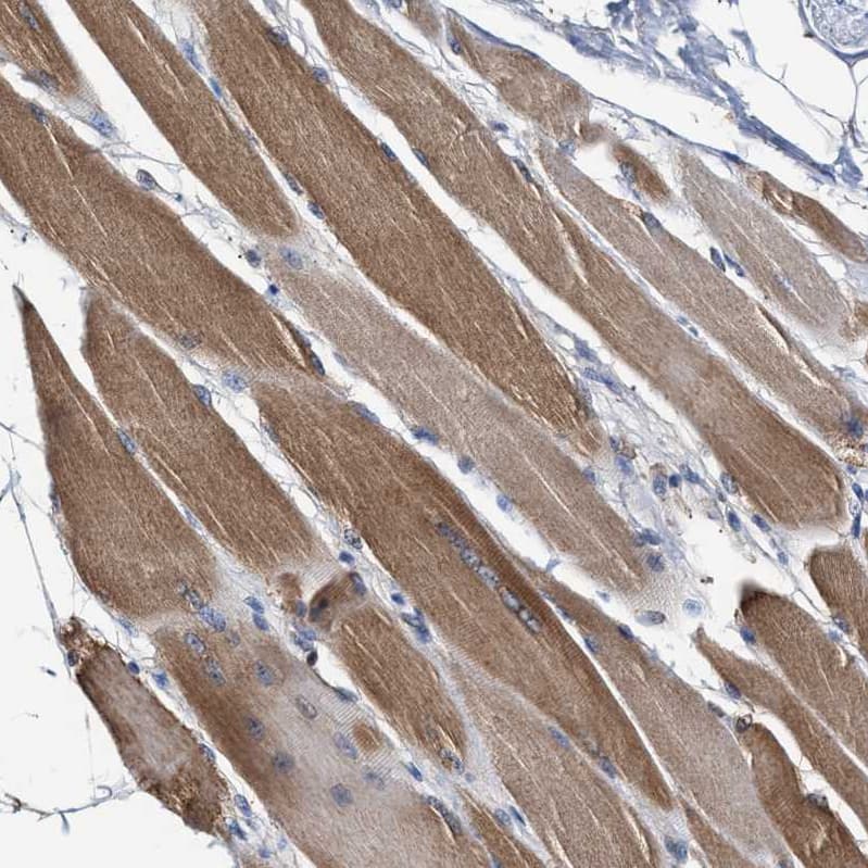 MECR Antibody - BSA Free Immunohistochemistry-Paraffin: MECR Antibody - BSA Free [NBP1-85659]