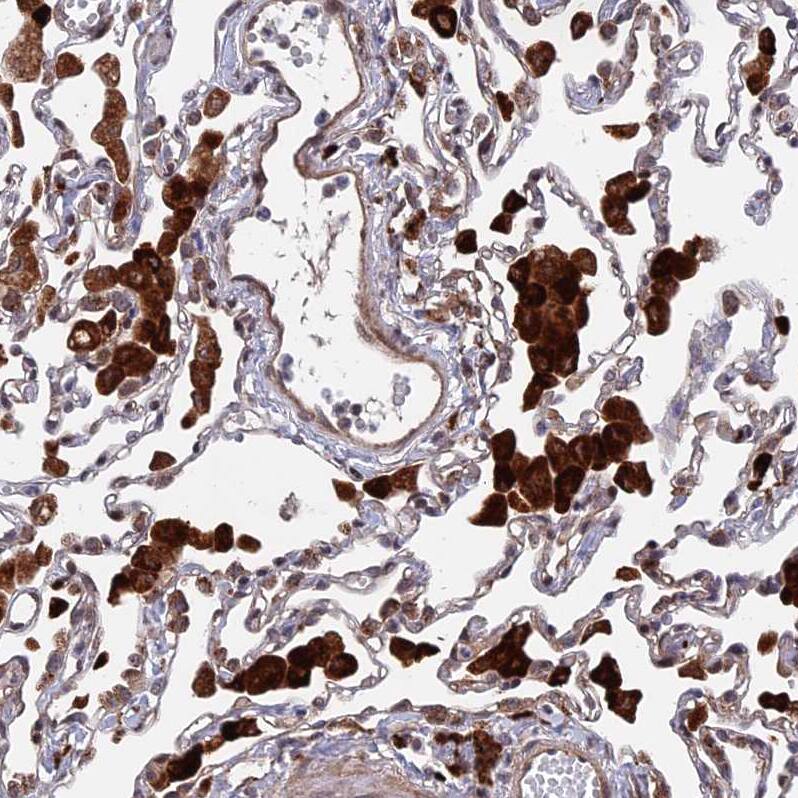 NOSIP Antibody - BSA Free Immunohistochemistry-Paraffin: NOSIP Antibody - BSA Free [NBP1-85661]