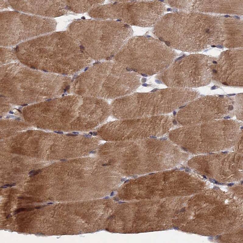 NOSIP Antibody - BSA Free Immunohistochemistry-Paraffin: NOSIP Antibody - BSA Free [NBP1-85661]