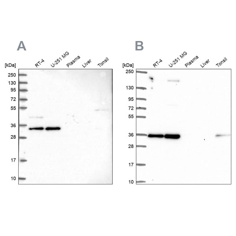 NOSIP Antibody - BSA Free Western Blot: NOSIP Antibody - BSA Free [NBP1-85661]
