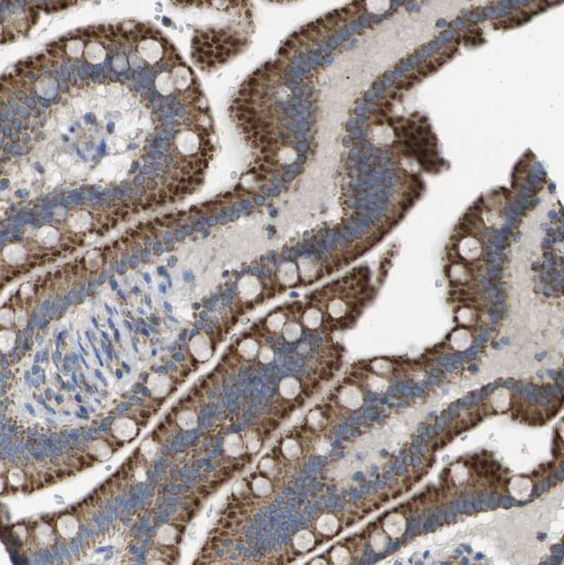 TTC11 Antibody - BSA Free Immunohistochemistry-Paraffin: TTC11 Antibody - BSA Free [NBP1-85664]