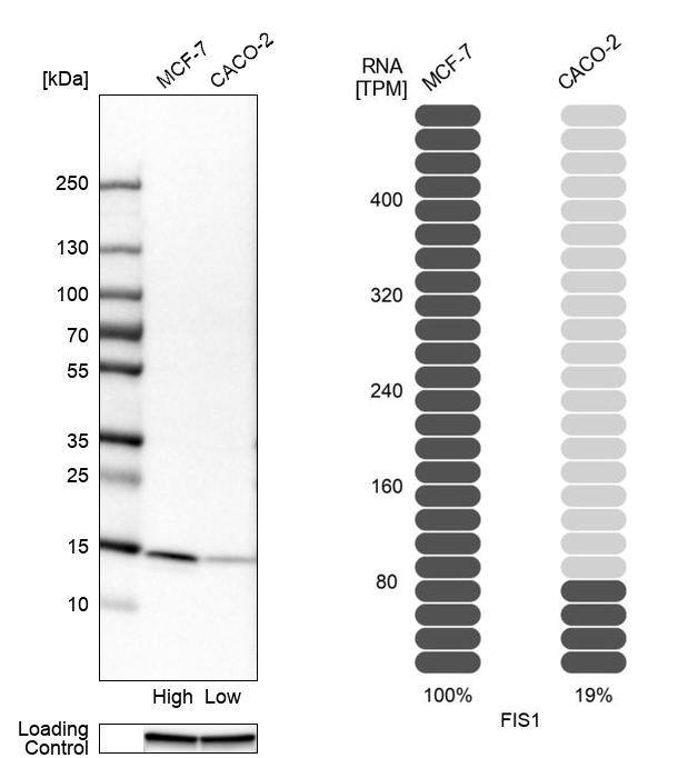 TTC11 Antibody - BSA Free Western Blot: TTC11 Antibody - BSA Free [NBP1-85664]