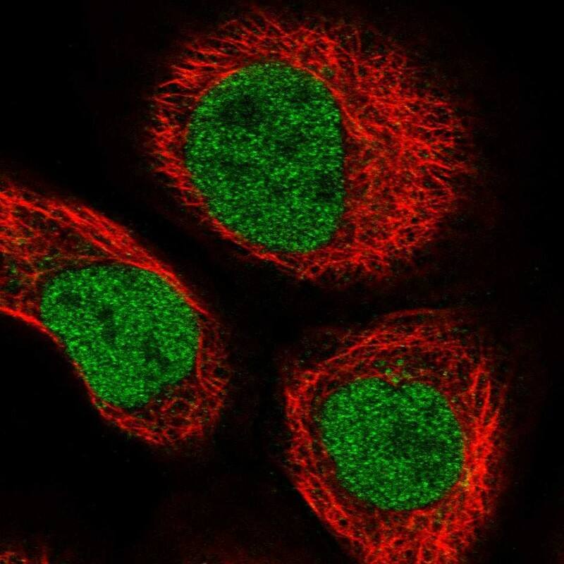 ZNHIT1 Antibody - BSA Free Immunocytochemistry/ Immunofluorescence: ZNHIT1 Antibody [NBP1-85673]