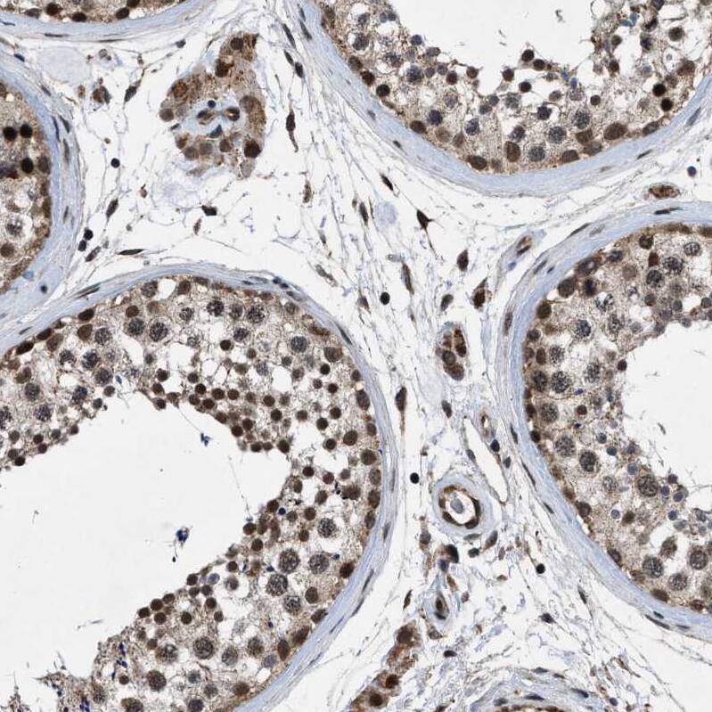 ZNHIT1 Antibody - BSA Free Immunohistochemistry-Paraffin: ZNHIT1 Antibody - BSA Free [NBP1-85673]