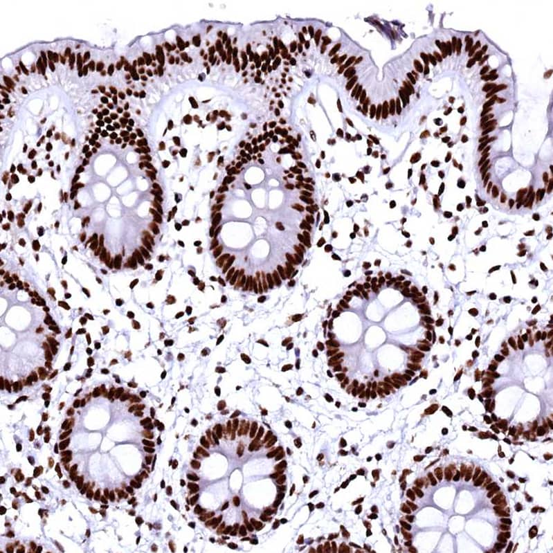 CPSF6 Antibody - BSA Free Immunohistochemistry-Paraffin: CPSF6 Antibody - BSA Free [NBP1-85676]