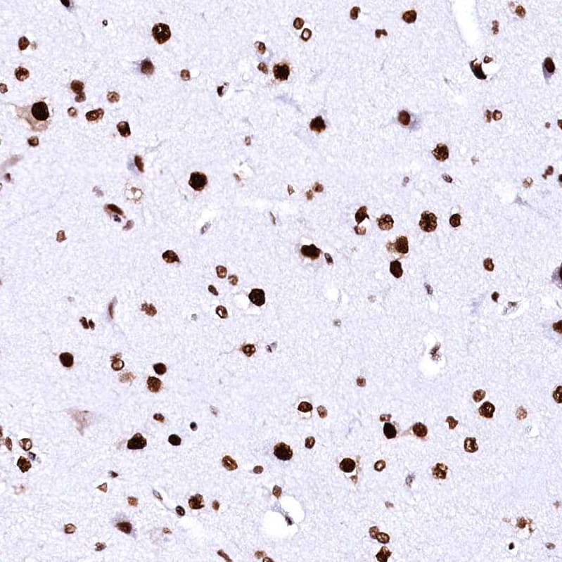 CPSF6 Antibody - BSA Free Immunohistochemistry-Paraffin: CPSF6 Antibody - BSA Free [NBP1-85676]