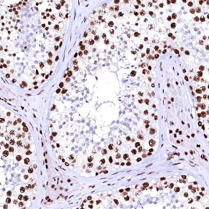 CPSF6 Antibody - BSA Free Immunohistochemistry-Paraffin: CPSF6 Antibody - BSA Free [NBP1-85676]