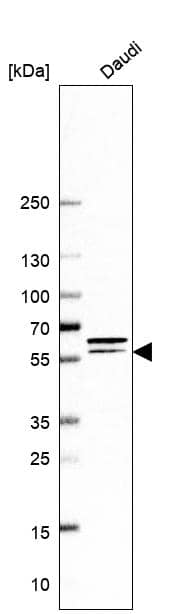 Fgr Antibody - BSA Free Western Blot: Fgr Antibody - BSA Free [NBP1-85677]