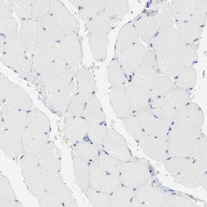 AADAC Antibody - BSA Free Immunohistochemistry-Paraffin: AADAC Antibody - BSA Free [NBP1-85680]