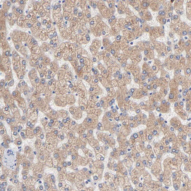 AADAC Antibody - BSA Free Immunohistochemistry-Paraffin: AADAC Antibody - BSA Free [NBP1-85680]