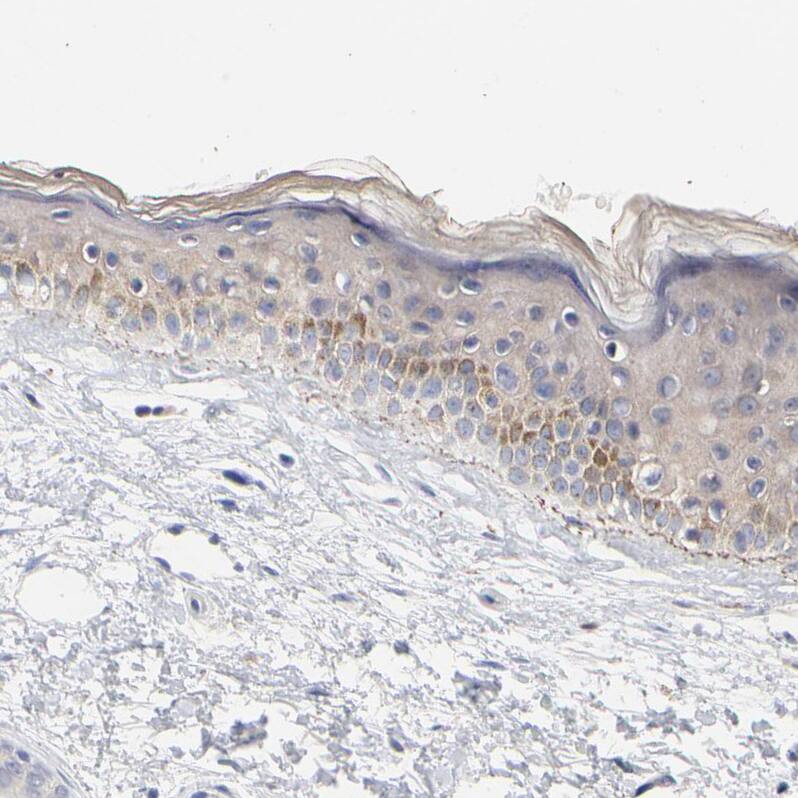 AADAC Antibody - BSA Free Immunohistochemistry-Paraffin: AADAC Antibody - BSA Free [NBP1-85680]