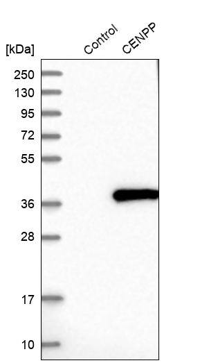 CENPP Antibody - BSA Free Western Blot: CENPP Antibody - BSA Free [NBP1-85688]