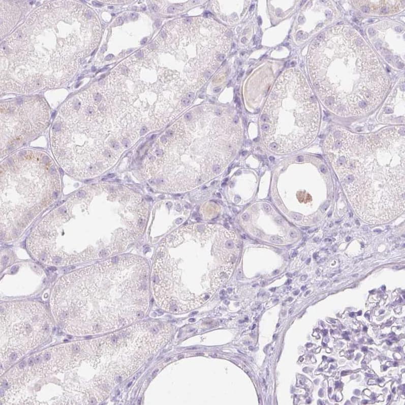Trappin-2/Elafin/Skalp Antibody - BSA Free Immunohistochemistry-Paraffin: Trappin-2/Elafin/Skalp Antibody [NBP1-85690]