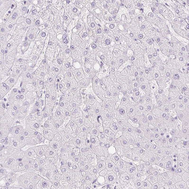 Trappin-2/Elafin/Skalp Antibody - BSA Free Immunohistochemistry-Paraffin: Trappin-2/Elafin/Skalp Antibody [NBP1-85690]
