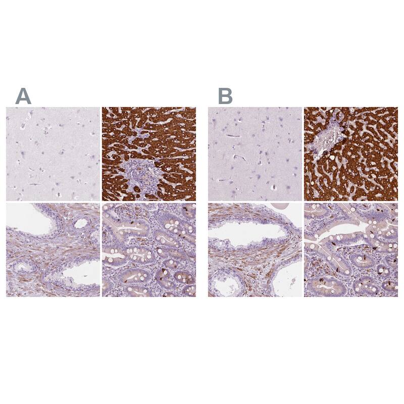Carboxylesterase 1/CES1 Antibody Immunohistochemistry-Paraffin: Carboxylesterase 1/CES1 Antibody Antibody [NBP1-85691]
