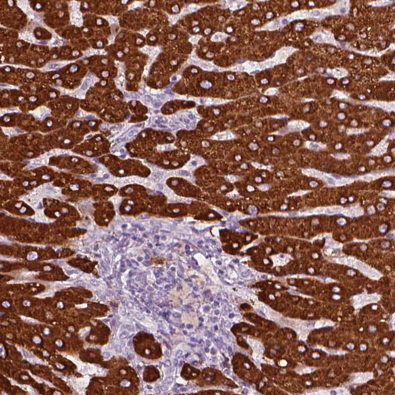 Carboxylesterase 1/CES1 Antibody - BSA Free Immunohistochemistry-Paraffin: Carboxylesterase 1/CES1 Antibody - BSA Free [NBP1-85691]