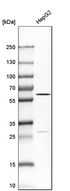 Carboxylesterase 1/CES1 Antibody - BSA Free Western Blot: Carboxylesterase 1/CES1 Antibody - BSA Free [NBP1-85691]