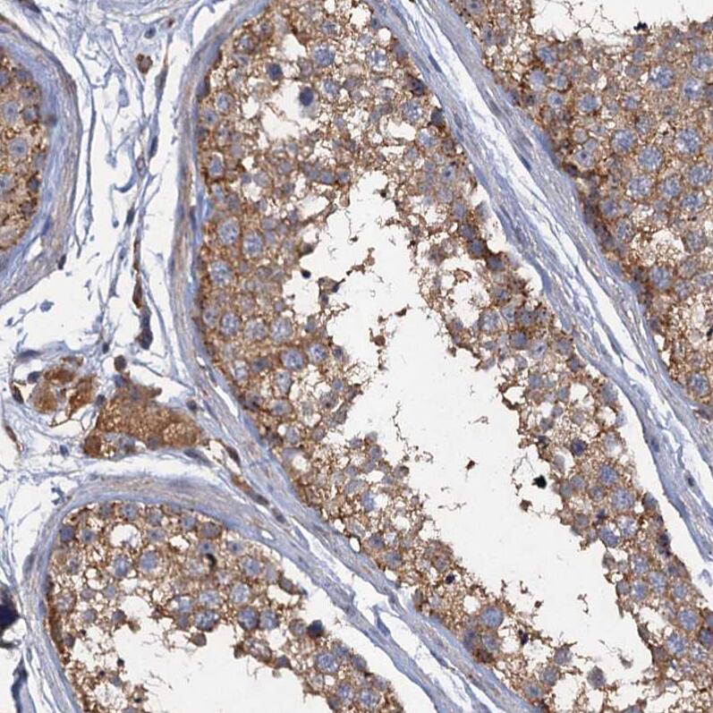 SCUBE3 Antibody - BSA Free Immunohistochemistry-Paraffin: SCUBE3 Antibody - BSA Free [NBP1-85692]
