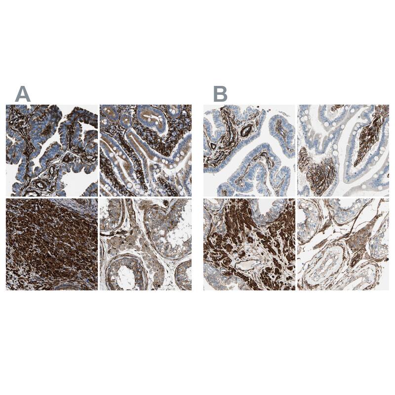 Caldesmon/CALD1 Antibody - BSA Free Immunohistochemistry-Paraffin: Caldesmon/CALD1 Antibody - BSA Free [NBP1-85701]