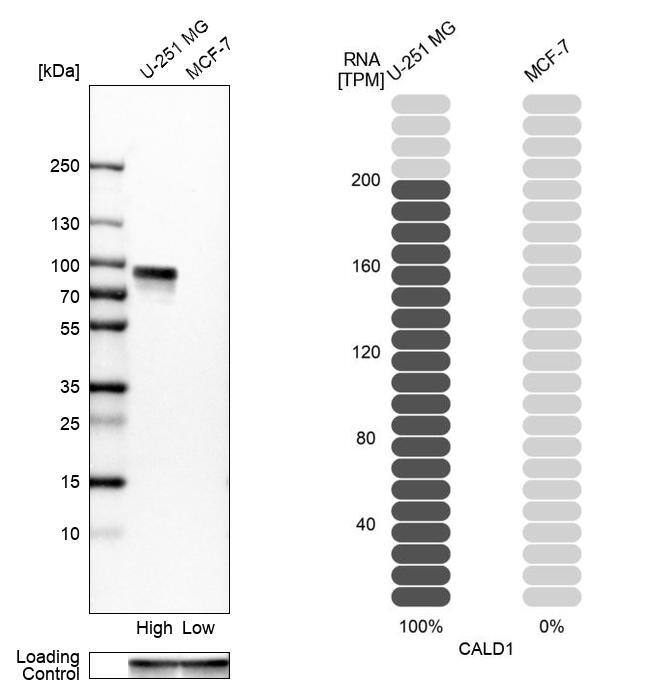 Caldesmon/CALD1 Antibody - BSA Free Western Blot: Caldesmon/CALD1 Antibody - BSA Free [NBP1-85701]