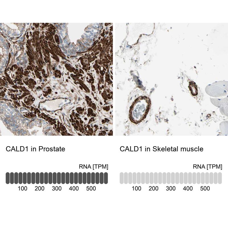 Caldesmon/CALD1 Antibody - BSA Free Immunohistochemistry-Paraffin: Caldesmon/CALD1 Antibody - BSA Free [NBP1-85702]
