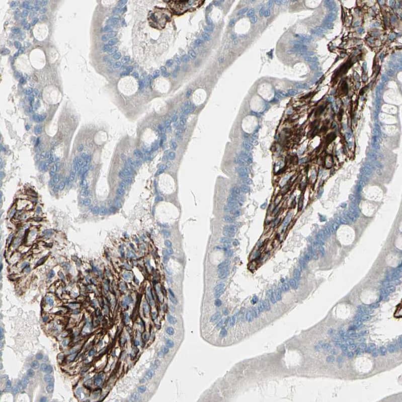 Caldesmon/CALD1 Antibody - BSA Free Immunohistochemistry-Paraffin: Caldesmon/CALD1 Antibody - BSA Free [NBP1-85702]