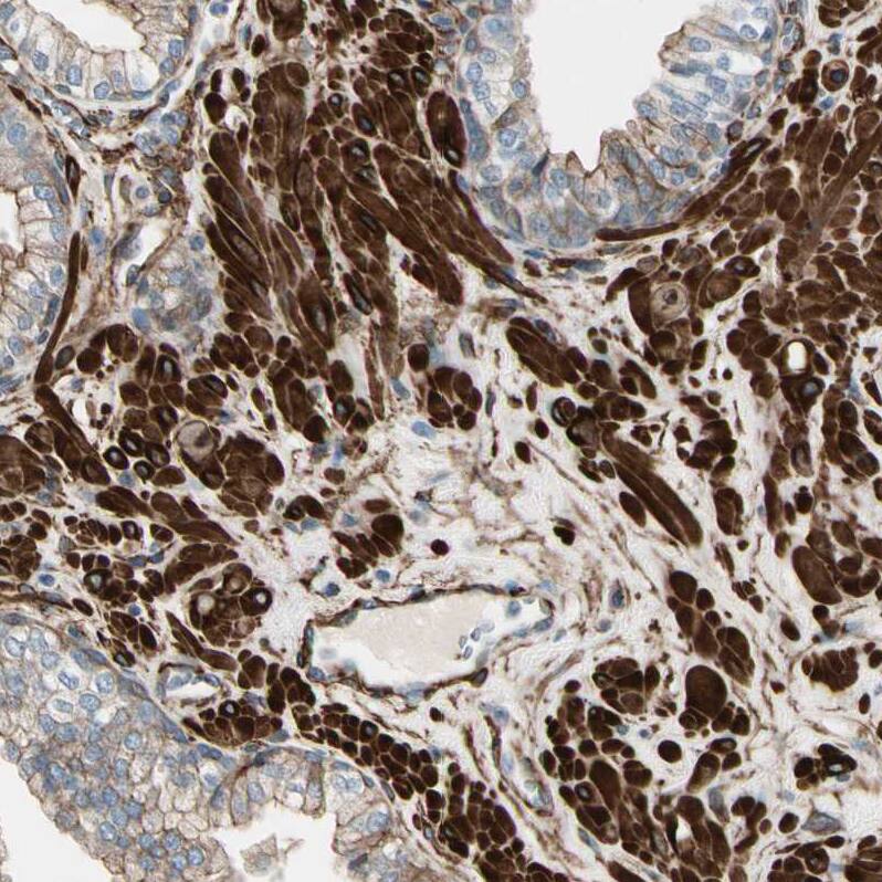Caldesmon/CALD1 Antibody - BSA Free Immunohistochemistry-Paraffin: Caldesmon/CALD1 Antibody - BSA Free [NBP1-85702]