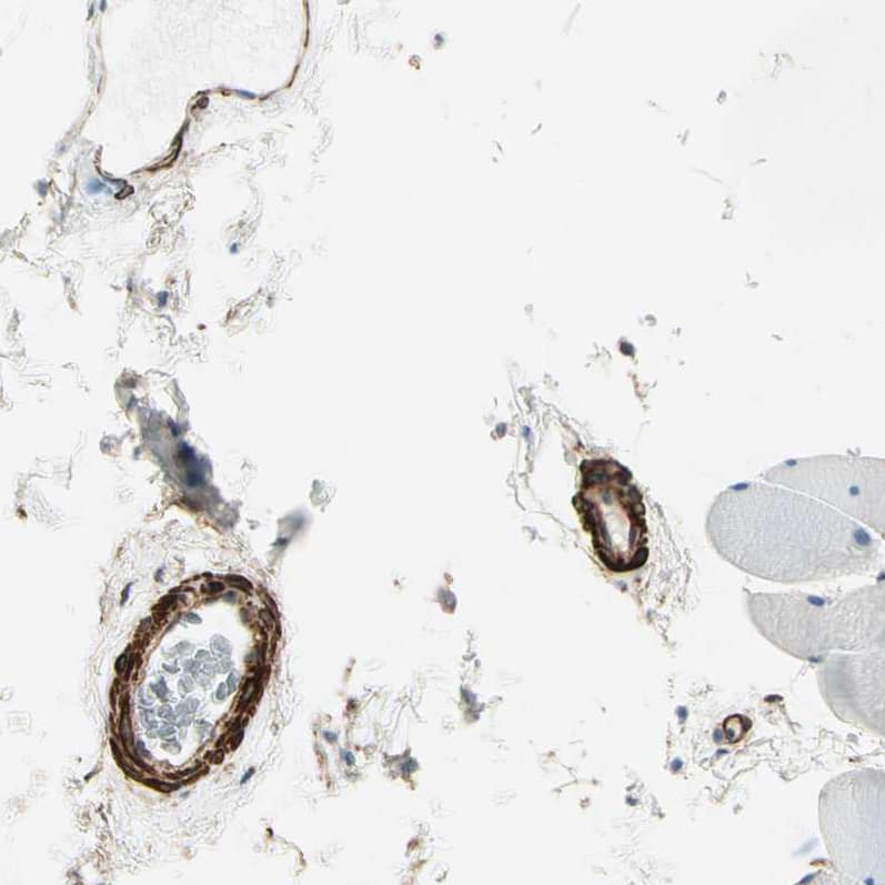 Caldesmon/CALD1 Antibody - BSA Free Immunohistochemistry-Paraffin: Caldesmon/CALD1 Antibody - BSA Free [NBP1-85702]