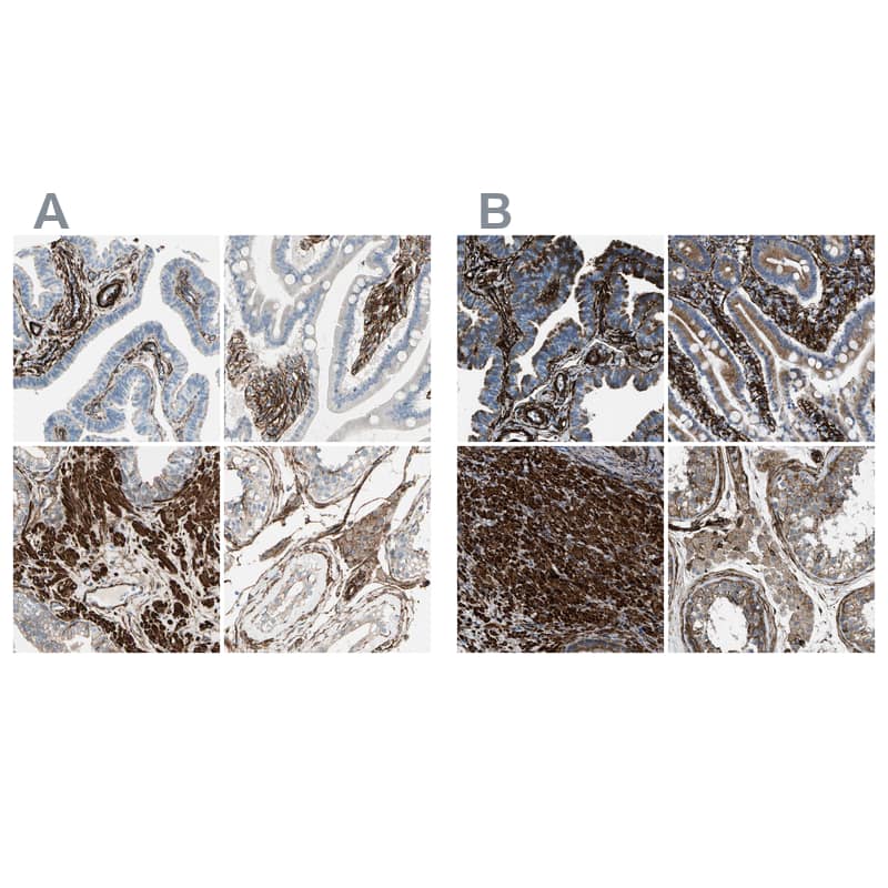 Caldesmon/CALD1 Antibody - BSA Free Immunohistochemistry-Paraffin: Caldesmon/CALD1 Antibody - BSA Free [NBP1-85702]