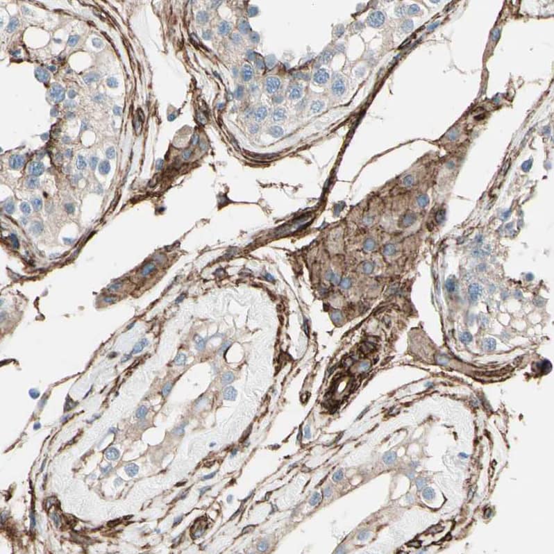 Caldesmon/CALD1 Antibody - BSA Free Immunohistochemistry-Paraffin: Caldesmon/CALD1 Antibody - BSA Free [NBP1-85702]