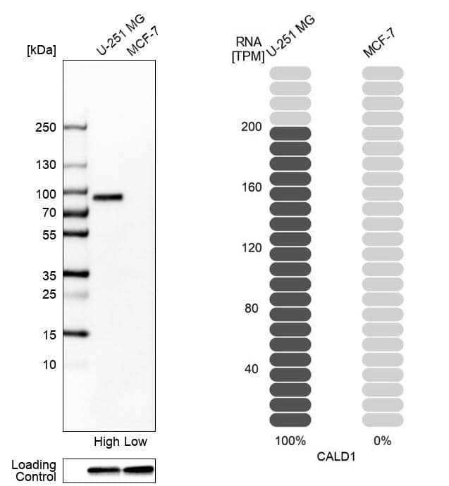 Caldesmon/CALD1 Antibody - BSA Free Western Blot: Caldesmon/CALD1 Antibody - BSA Free [NBP1-85702]