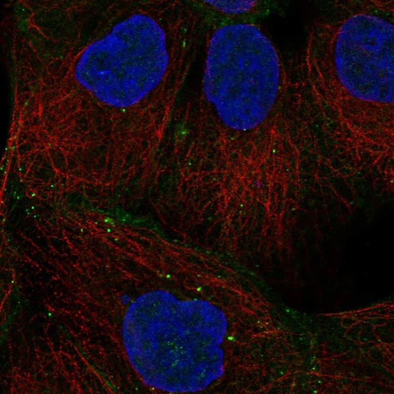 Desmoglein-2 Antibody - BSA Free Immunocytochemistry/ Immunofluorescence: Desmoglein-2 Antibody [NBP1-85709]