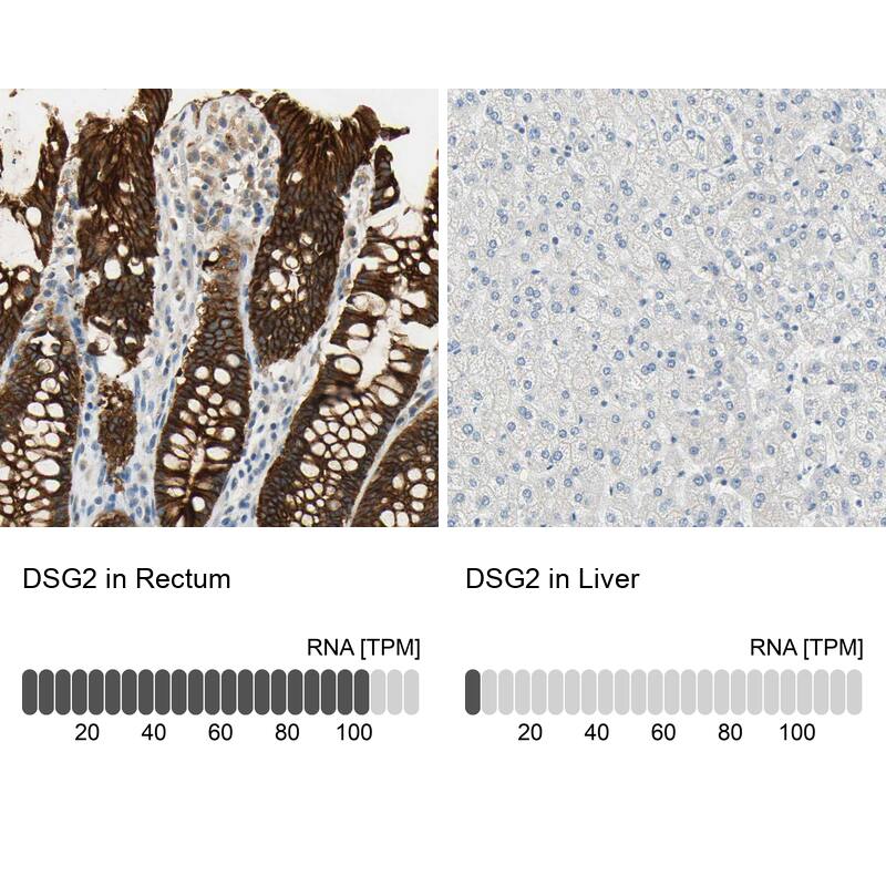 Desmoglein-2 Antibody - BSA Free Immunohistochemistry-Paraffin: Desmoglein-2 Antibody - BSA Free [NBP1-85709]