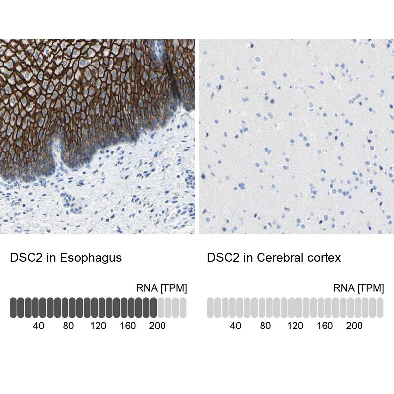 Desmocollin-2 Antibody - BSA Free Immunohistochemistry-Paraffin: Desmocollin-2 Antibody - BSA Free [NBP1-85711]