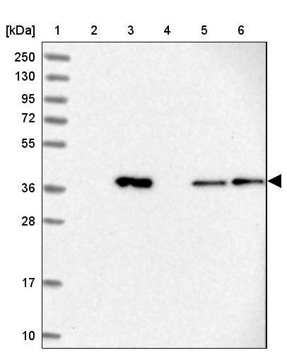 ALG2 Antibody - BSA Free Western Blot: ALG2 Antibody - BSA Free [NBP1-85715]