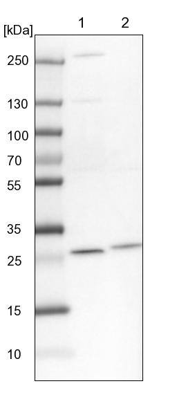 PMM2/Phosphomannomutase 2 Antibody - BSA Free Western Blot: PMM2/Phosphomannomutase 2 Antibody - BSA Free [NBP1-85716]