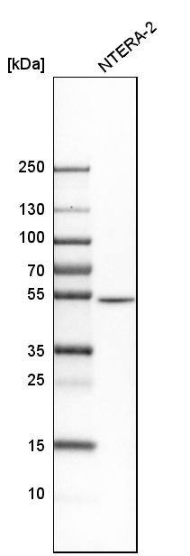 Septin-7 Antibody - BSA Free Western Blot: Septin-7 Antibody - BSA Free [NBP1-85730]