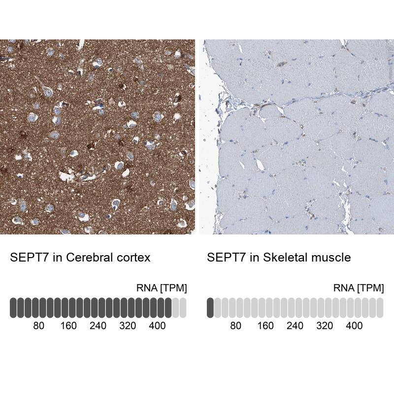 Septin-7 Antibody - BSA Free Immunohistochemistry-Paraffin: Septin-7 Antibody [NBP1-85731]
