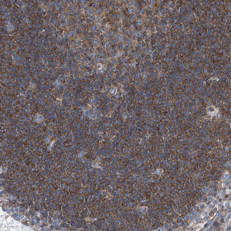 Septin-7 Antibody - BSA Free Immunohistochemistry-Paraffin: Septin-7 Antibody [NBP1-85731]