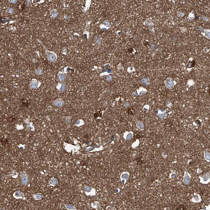 Septin-7 Antibody - BSA Free Immunohistochemistry-Paraffin: Septin-7 Antibody [NBP1-85731]